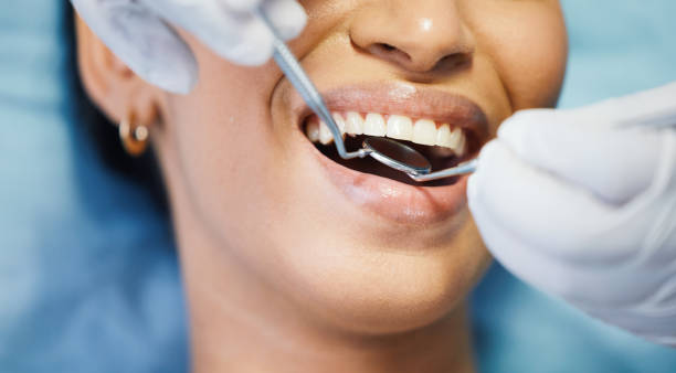 Best Knocked-Out Tooth (Avulsed Tooth) Treatment in Anna, TX