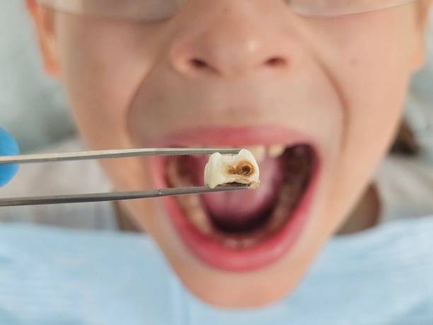 Best Emergency Dental Care for Sports Injuries in Anna, TX